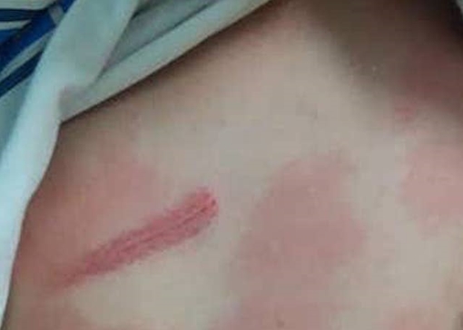 Khởi tố cô ruột đánh cháu trai thương tích 13%